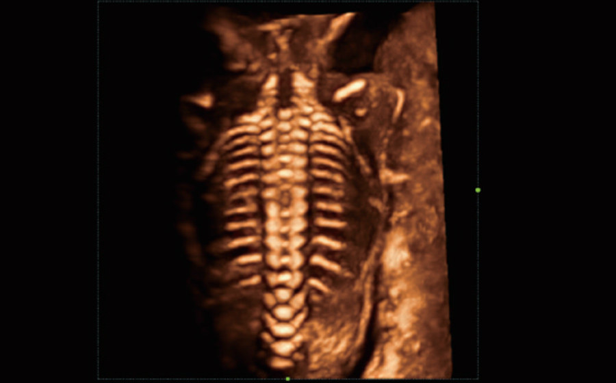 Fetal circulation flow